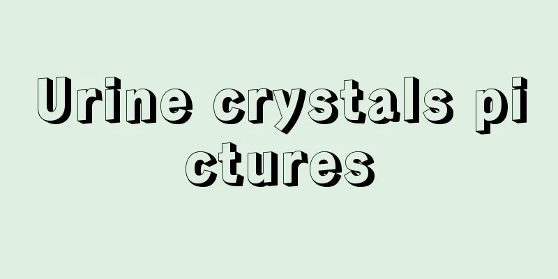 Urine crystals pictures