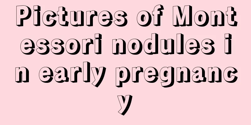 Pictures of Montessori nodules in early pregnancy