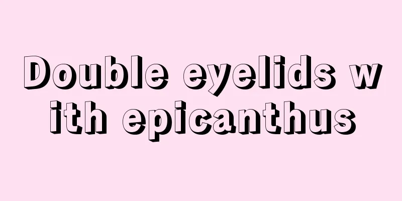 Double eyelids with epicanthus