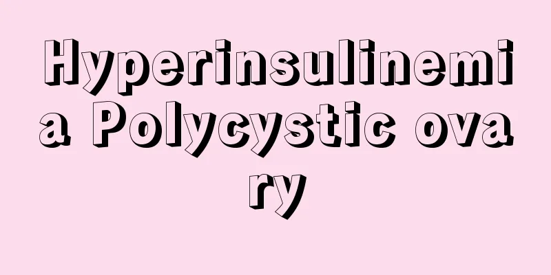 Hyperinsulinemia Polycystic ovary