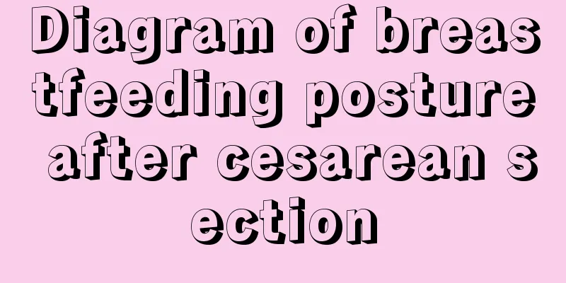 Diagram of breastfeeding posture after cesarean section