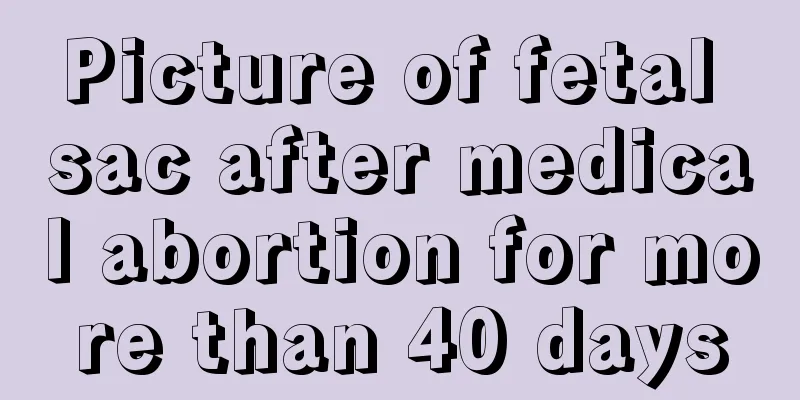 Picture of fetal sac after medical abortion for more than 40 days