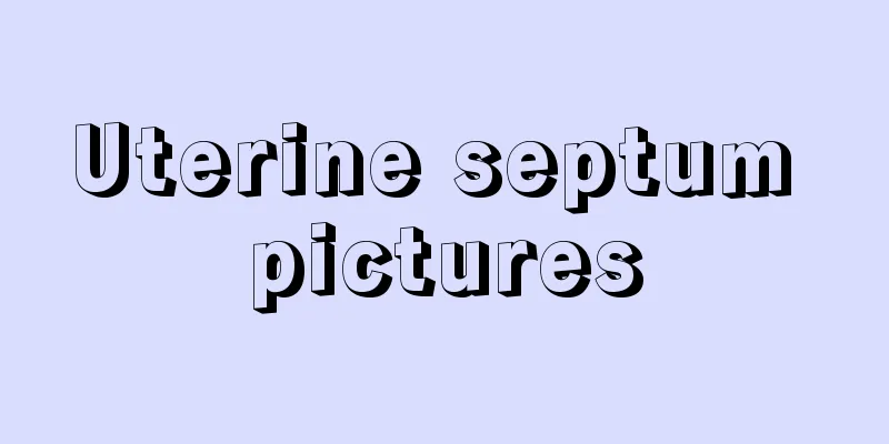 Uterine septum pictures