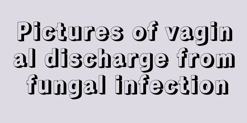 Pictures of vaginal discharge from fungal infection