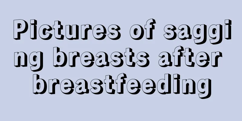 Pictures of sagging breasts after breastfeeding