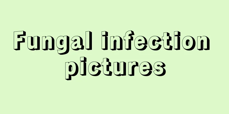 Fungal infection pictures