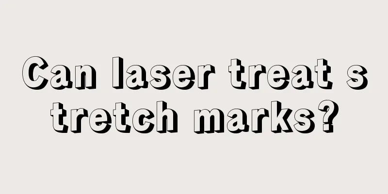 Can laser treat stretch marks?