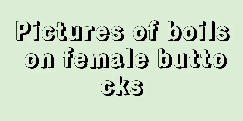 Pictures of boils on female buttocks