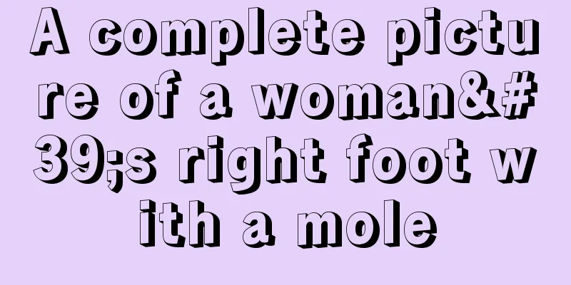 A complete picture of a woman's right foot with a mole