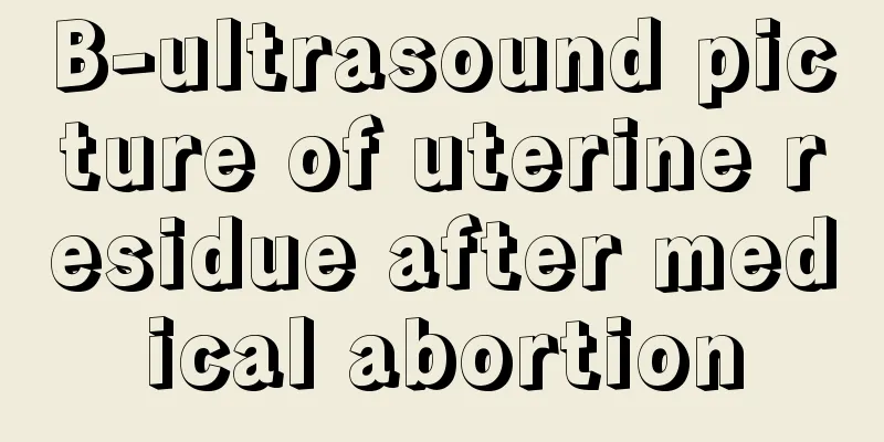 B-ultrasound picture of uterine residue after medical abortion