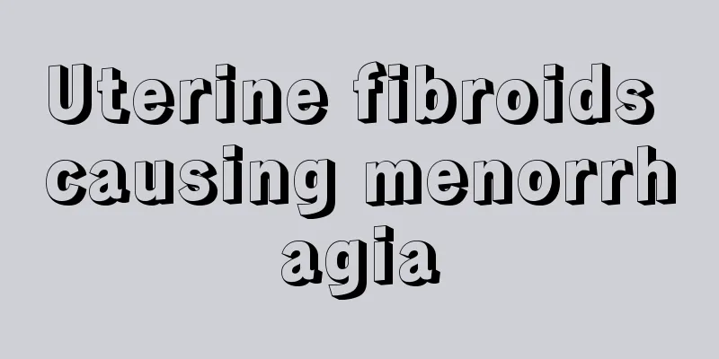 Uterine fibroids causing menorrhagia