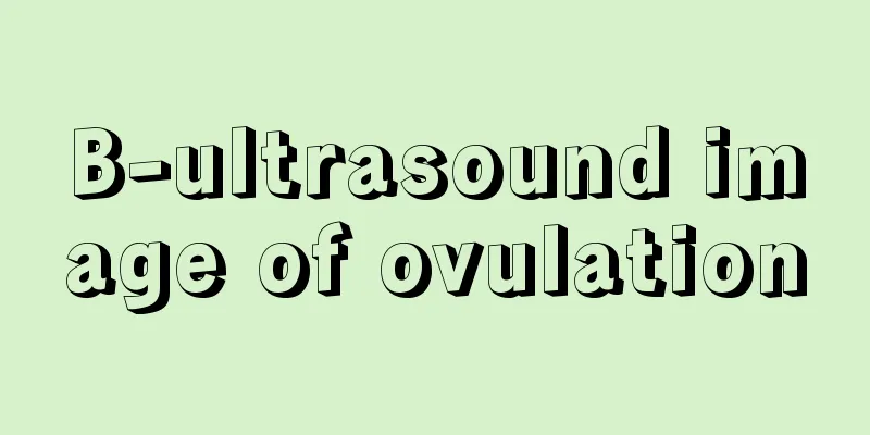 B-ultrasound image of ovulation