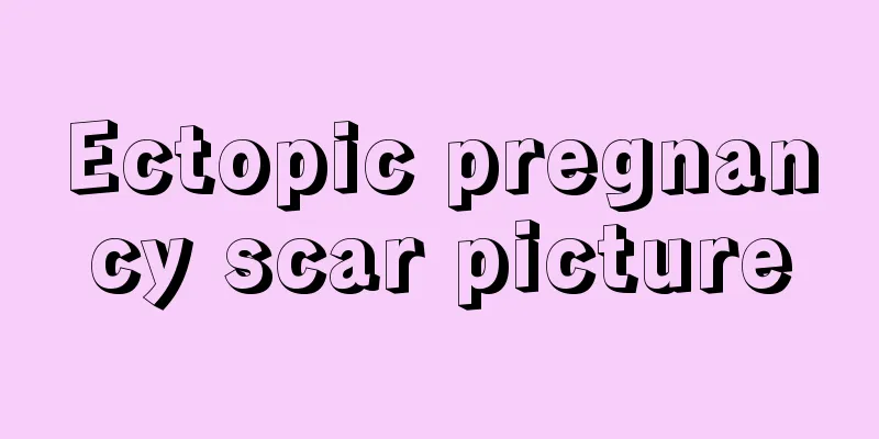 Ectopic pregnancy scar picture