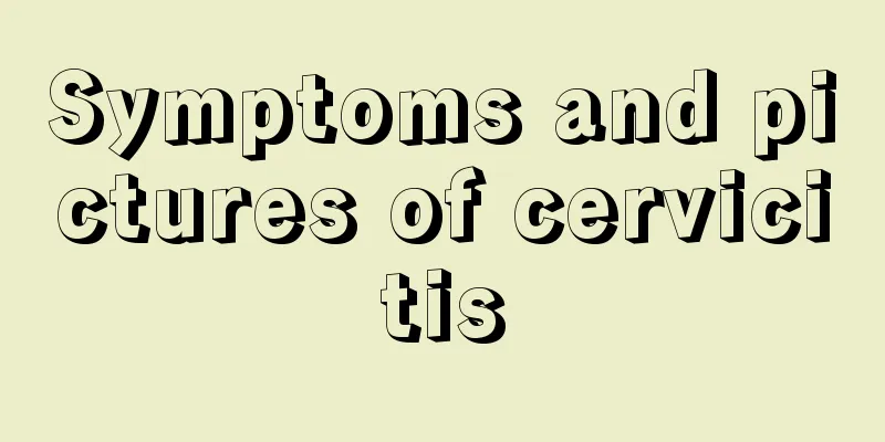 Symptoms and pictures of cervicitis