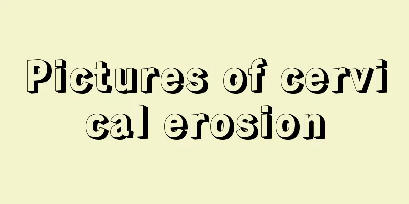 Pictures of cervical erosion