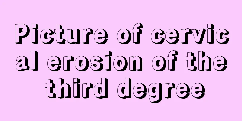 Picture of cervical erosion of the third degree