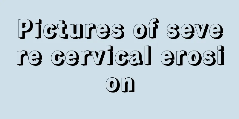 Pictures of severe cervical erosion