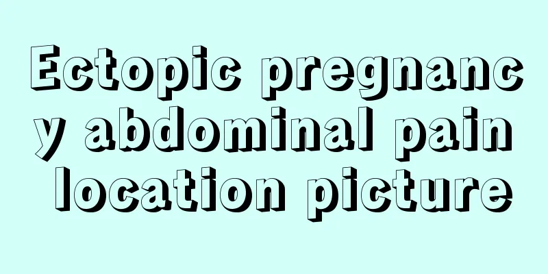 Ectopic pregnancy abdominal pain location picture