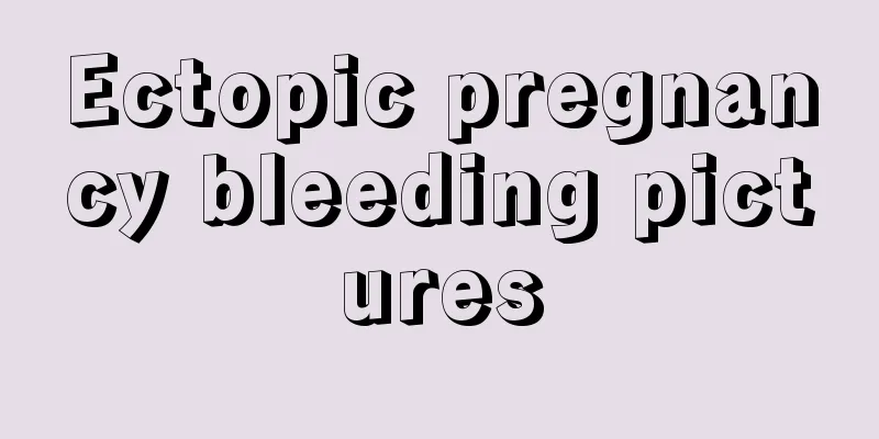 Ectopic pregnancy bleeding pictures