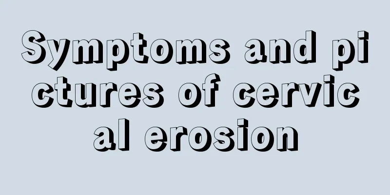 Symptoms and pictures of cervical erosion