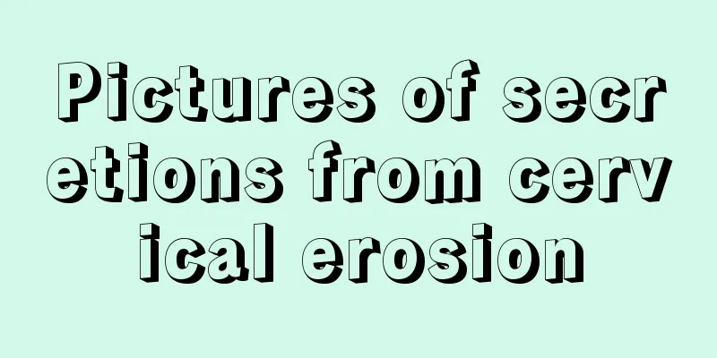 Pictures of secretions from cervical erosion