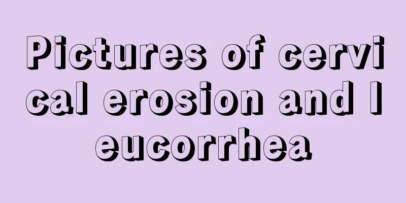 Pictures of cervical erosion and leucorrhea