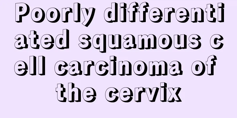 Poorly differentiated squamous cell carcinoma of the cervix