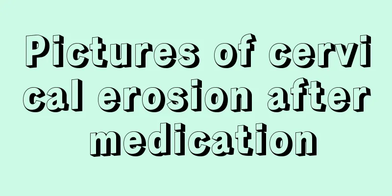 Pictures of cervical erosion after medication