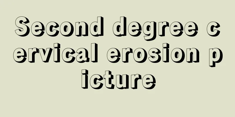 Second degree cervical erosion picture