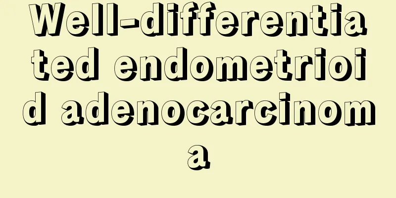 Well-differentiated endometrioid adenocarcinoma