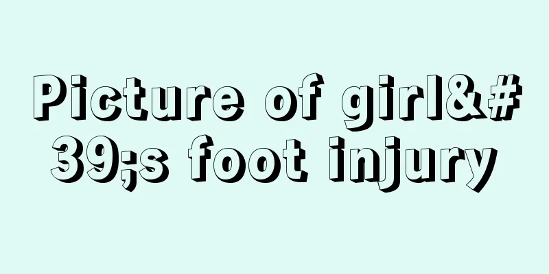 Picture of girl's foot injury