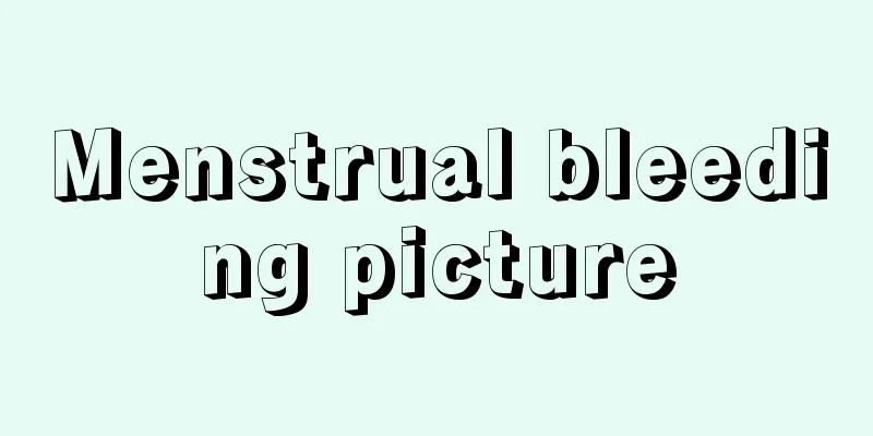 Menstrual bleeding picture