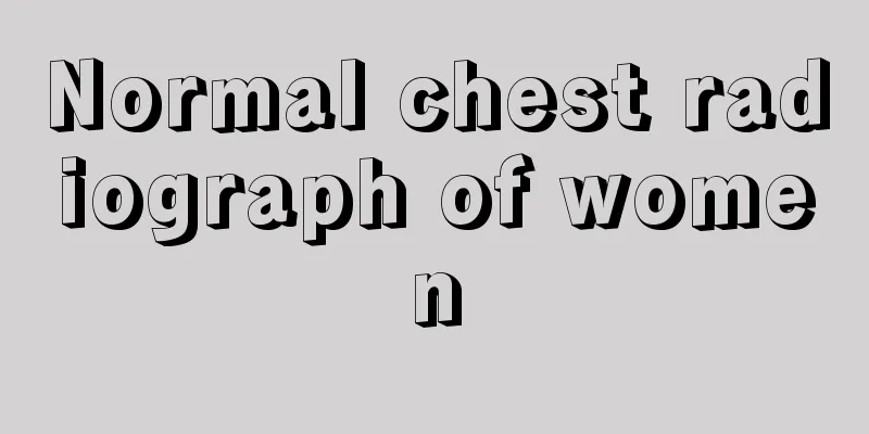 Normal chest radiograph of women