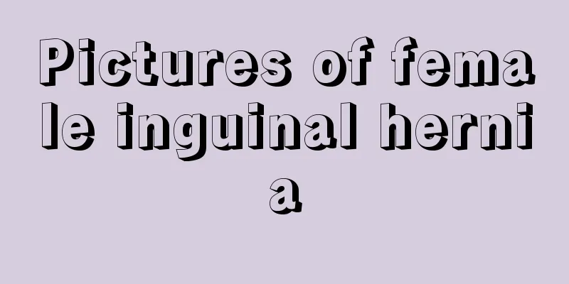 Pictures of female inguinal hernia