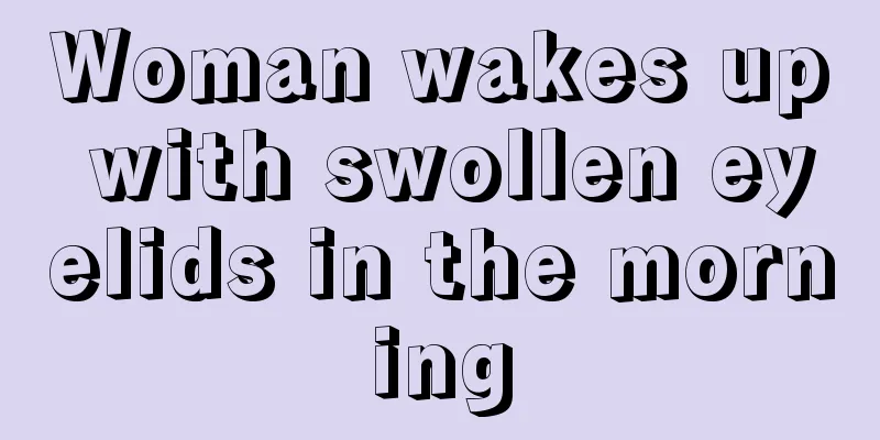 Woman wakes up with swollen eyelids in the morning