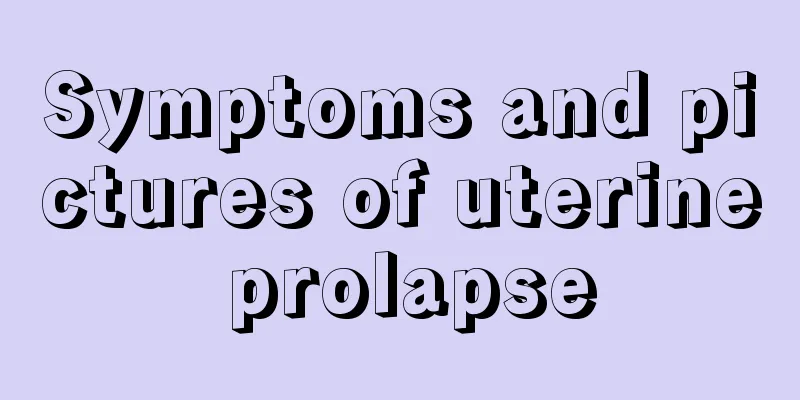 Symptoms and pictures of uterine prolapse