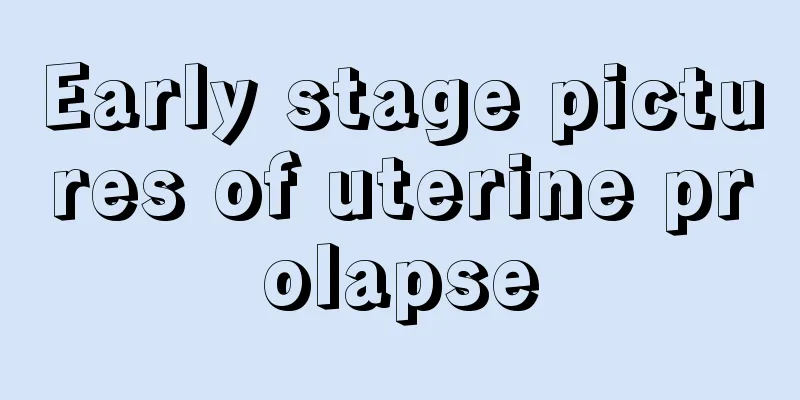 Early stage pictures of uterine prolapse