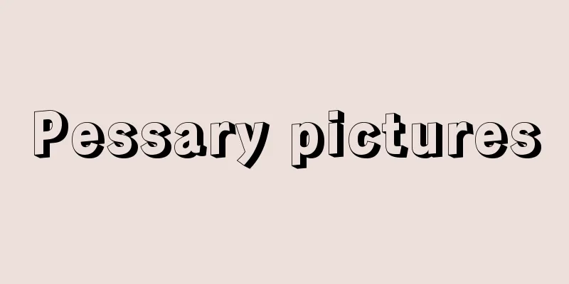 Pessary pictures