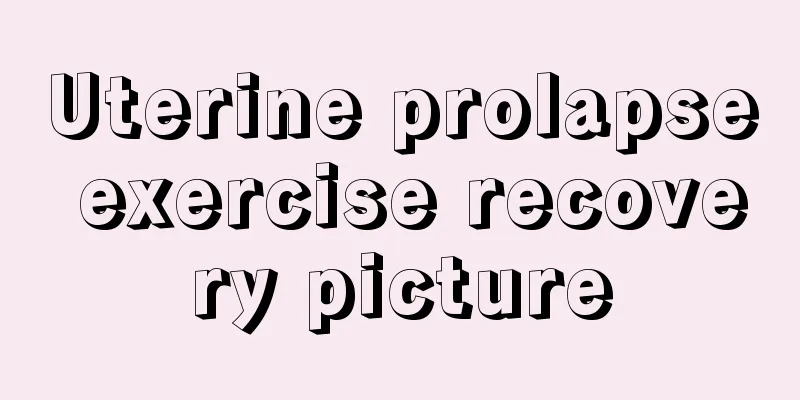 Uterine prolapse exercise recovery picture