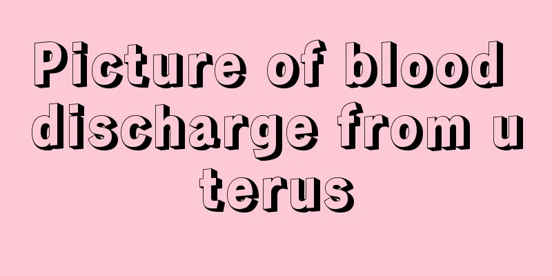 Picture of blood discharge from uterus