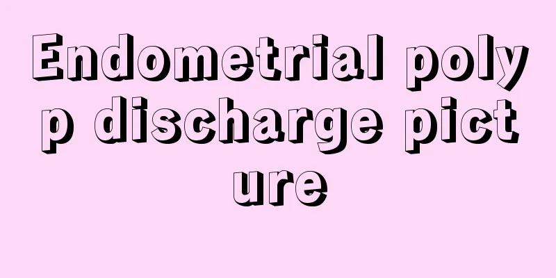 Endometrial polyp discharge picture