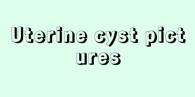 Uterine cyst pictures