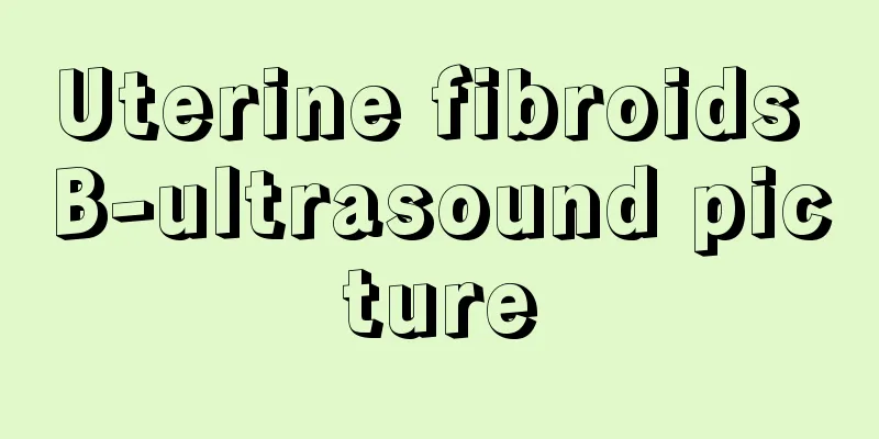 Uterine fibroids B-ultrasound picture