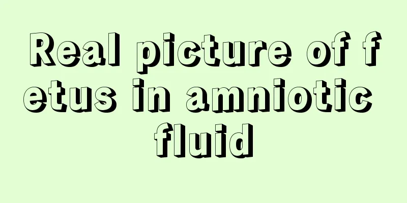 Real picture of fetus in amniotic fluid