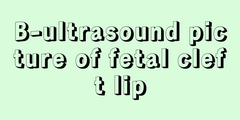 B-ultrasound picture of fetal cleft lip