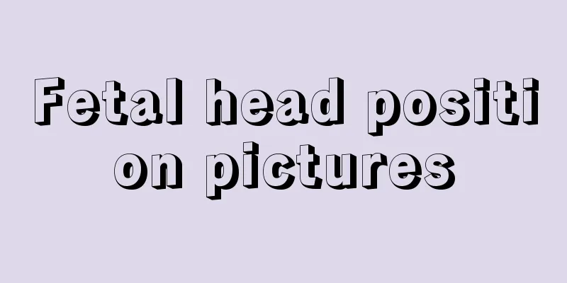 Fetal head position pictures