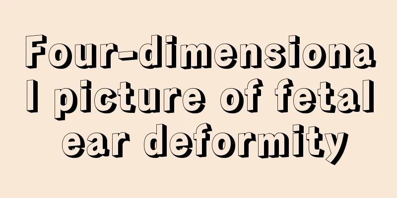 Four-dimensional picture of fetal ear deformity