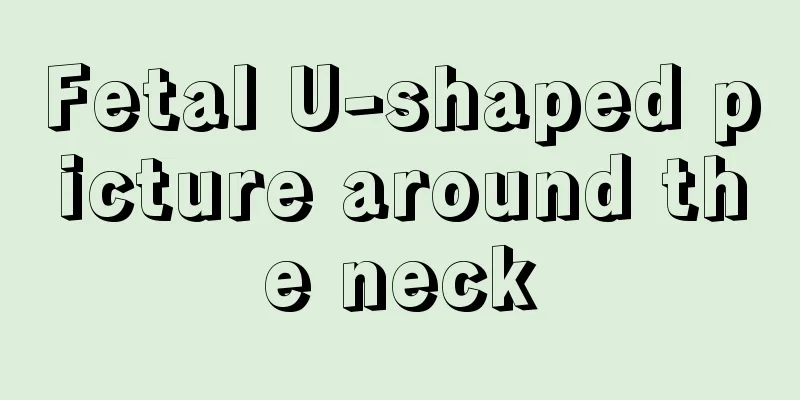 Fetal U-shaped picture around the neck