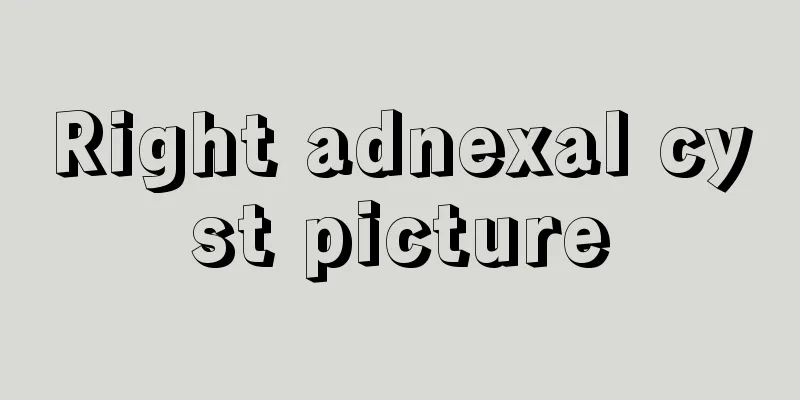 Right adnexal cyst picture