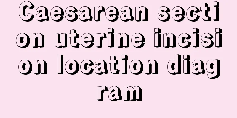 Caesarean section uterine incision location diagram